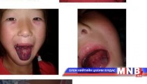  Эмнэлгийн ажилтнуудын буруутай үйл ажиллагаанд хэрэг үүсгэн шалгаж байна
