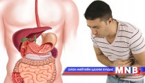 Хоол боловсруулах эрхтний өвчлөлийн шалтгаан...