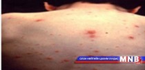 13 цэргийг тусгаарлан эмчилж байна 