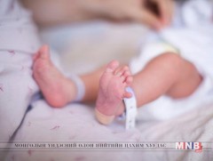 Төв аймгийн хэмжээнд ураг нярайн скрининг шинжилгээг 1000 нярайд хийнэ