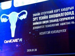 Умайн хүзүүний хавдрын эрт илрүүлгийг таван секундийн дотор хийж байна